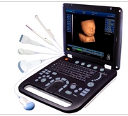 B/W 4D Laptop Ultrasound System