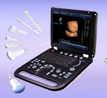 ultrasound, B/W, laptop, 3D.