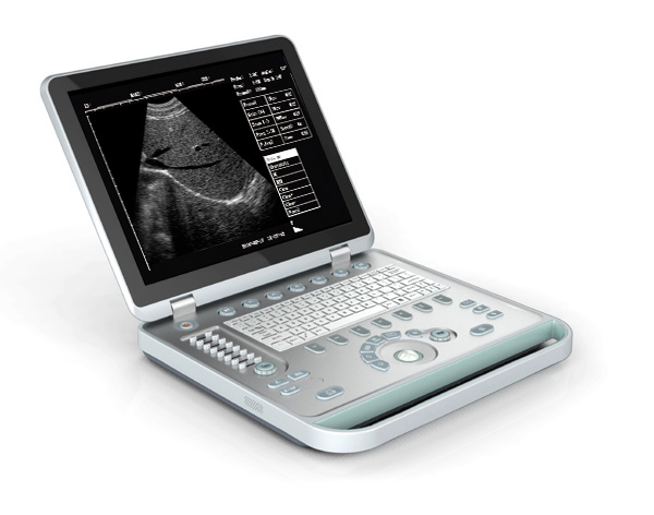 Laptop Ultrasound Scanner SG-S7