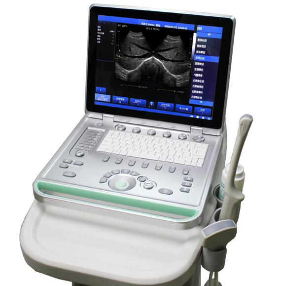 Laptop ultrasound scanner SG-S8