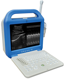 Digital Laptop Ultrasound Scanner/ultrasound uses/ private ultrasound/ultrasound scans
