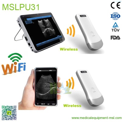 wireless ultrasound probe MSLPU31
