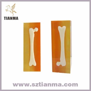 Acrylic bone model paperweight medical doc. souvenir gift - TM1304