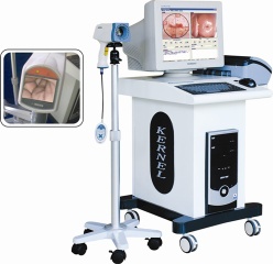 Video  Digital Colposcope For Gynecology