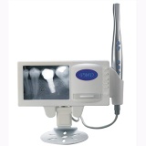 DIGITAL X-RAY Reader with CMOS Dental Cam
