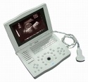 Laptop Ultrasound Scanner-RSD-RP6A(HUMAN