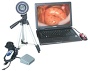 colposcope system