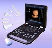B/W Portable Ultrasound Scanner, 3D&2D