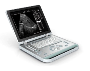 Smart Laptop B/W Ultrasound Scanner with Convex probe SG-S7