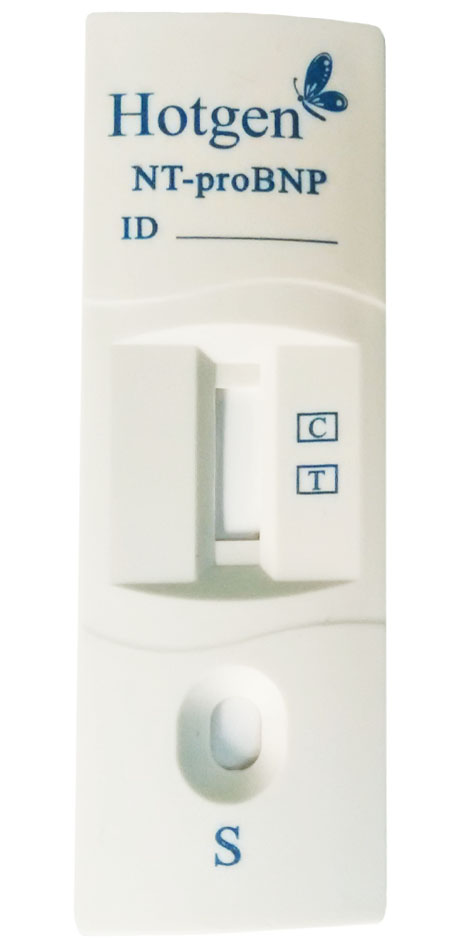 NT-proBNP