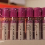 Disp[osable blood collection EDTA k2 k3 Na2 Purple Tube