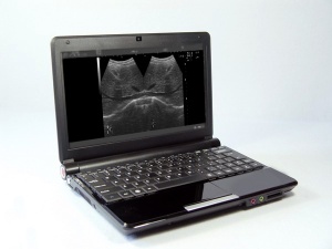 digital laptop ultrasound machine