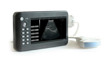Hand carried digital diagnostic Ultrasound