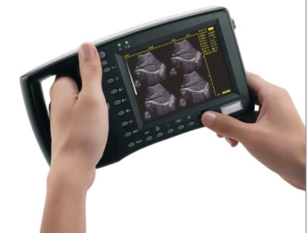 Palmtop Ultrasound Scanner for human