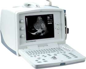 WEUC-603  Convex Ultrasound Scanner - Ultrasound Scanner