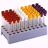 Diagnostic Blood Collection Tube